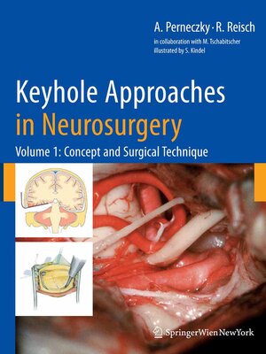 cover image of Keyhole Approaches in Neurosurgery